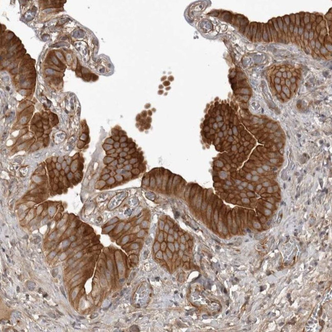 ARL5A Antibody in Immunohistochemistry (IHC)