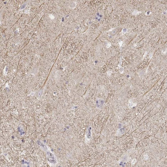 Kir2.2 (KCNJ12) Antibody in Immunohistochemistry (IHC)
