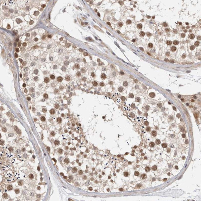 ZNF318 Antibody in Immunohistochemistry (Paraffin) (IHC (P))