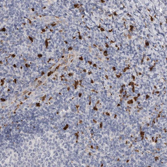 CYB561D1 Antibody in Immunohistochemistry (Paraffin) (IHC (P))