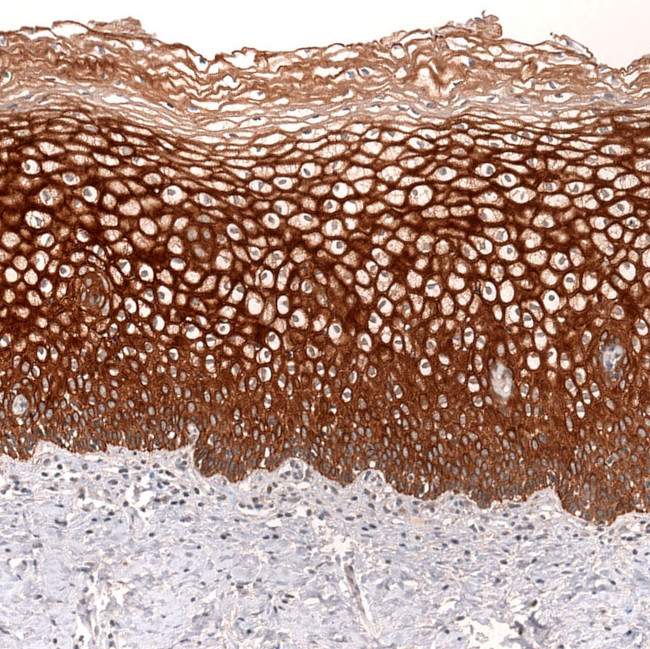 VANGL2 Antibody in Immunohistochemistry (Paraffin) (IHC (P))