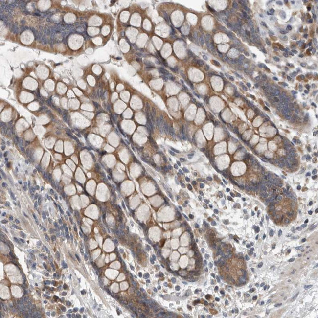 TMEM199 Antibody in Immunohistochemistry (Paraffin) (IHC (P))