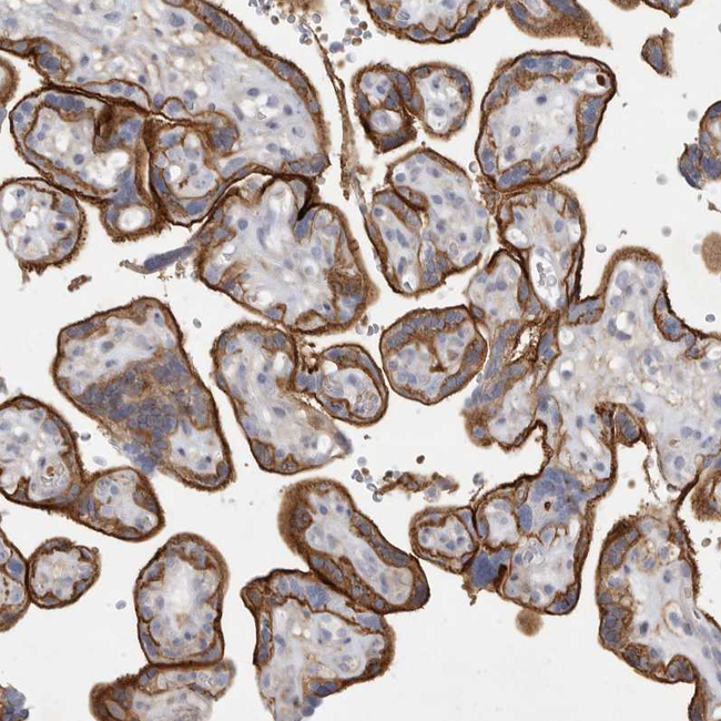 TPCN2 Antibody in Immunohistochemistry (Paraffin) (IHC (P))