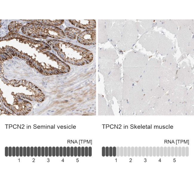 TPCN2 Antibody in Immunohistochemistry (IHC)