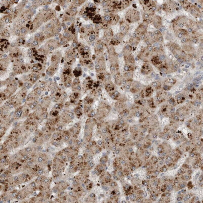 SCP2 Antibody in Immunohistochemistry (IHC)