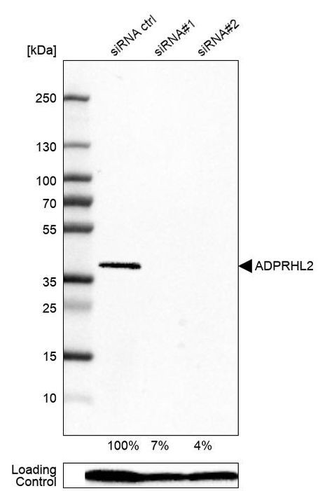 ADPRHL2 Antibody