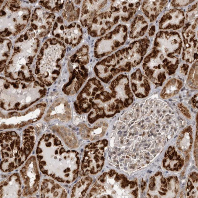 C1orf109 Antibody in Immunohistochemistry (Paraffin) (IHC (P))