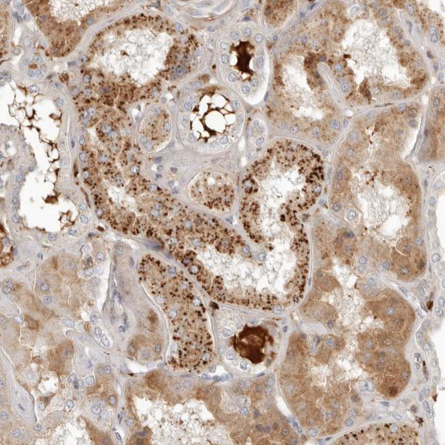 KLHL38 Antibody in Immunohistochemistry (Paraffin) (IHC (P))