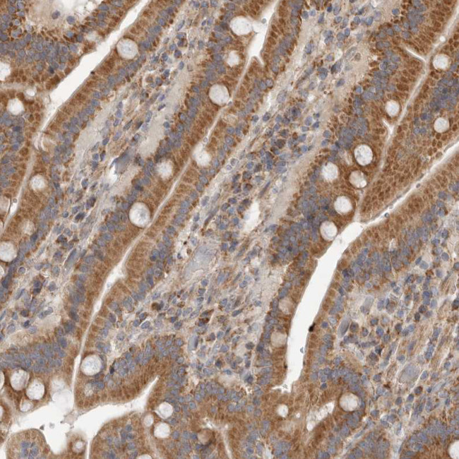MTFR1L Antibody in Immunohistochemistry (IHC)