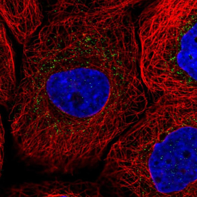 SCP2 Antibody in Immunocytochemistry (ICC/IF)