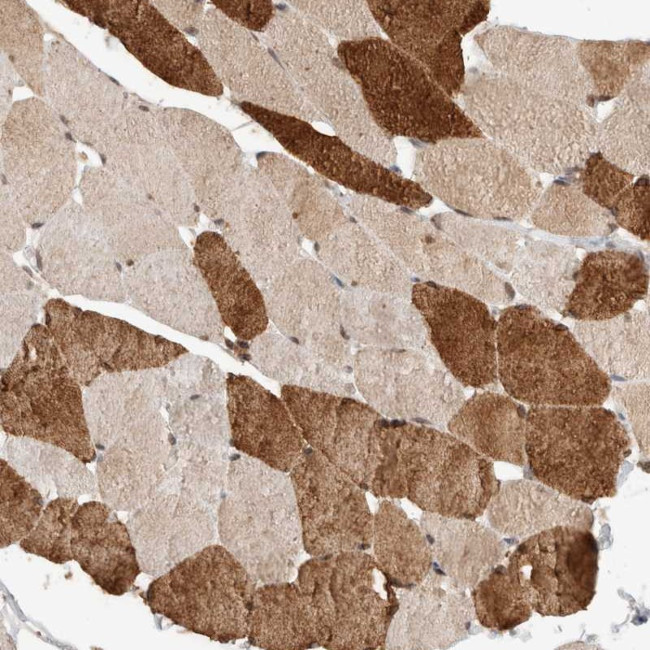 SYDE2 Antibody in Immunohistochemistry (Paraffin) (IHC (P))