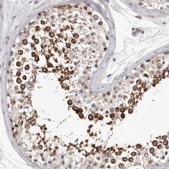 RALGPS2 Antibody in Immunohistochemistry (Paraffin) (IHC (P))