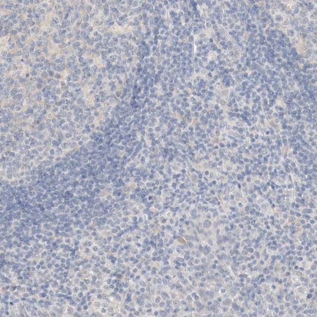 SPATA20 Antibody in Immunohistochemistry (Paraffin) (IHC (P))