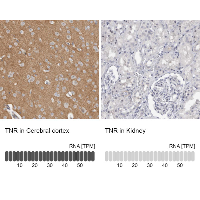 Tenascin R Antibody in Immunohistochemistry (IHC)