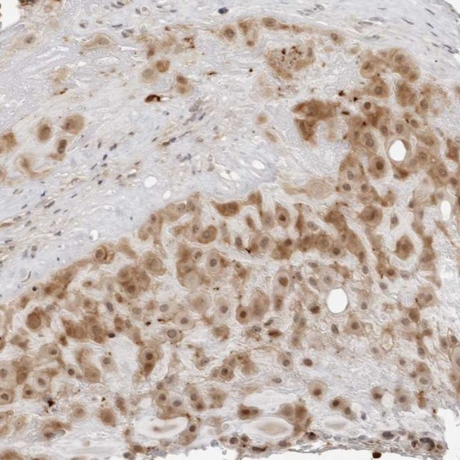 RNF146 Antibody in Immunohistochemistry (IHC)