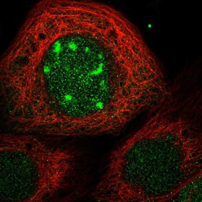 CDCA7L Antibody in Immunocytochemistry (ICC/IF)