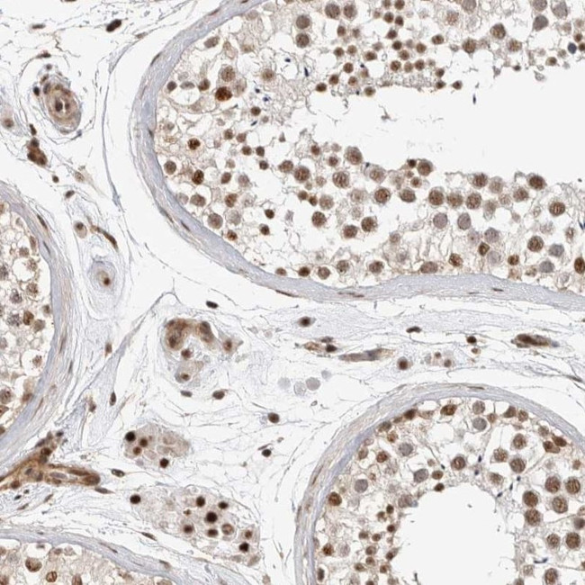 GPATCH2 Antibody in Immunohistochemistry (IHC)