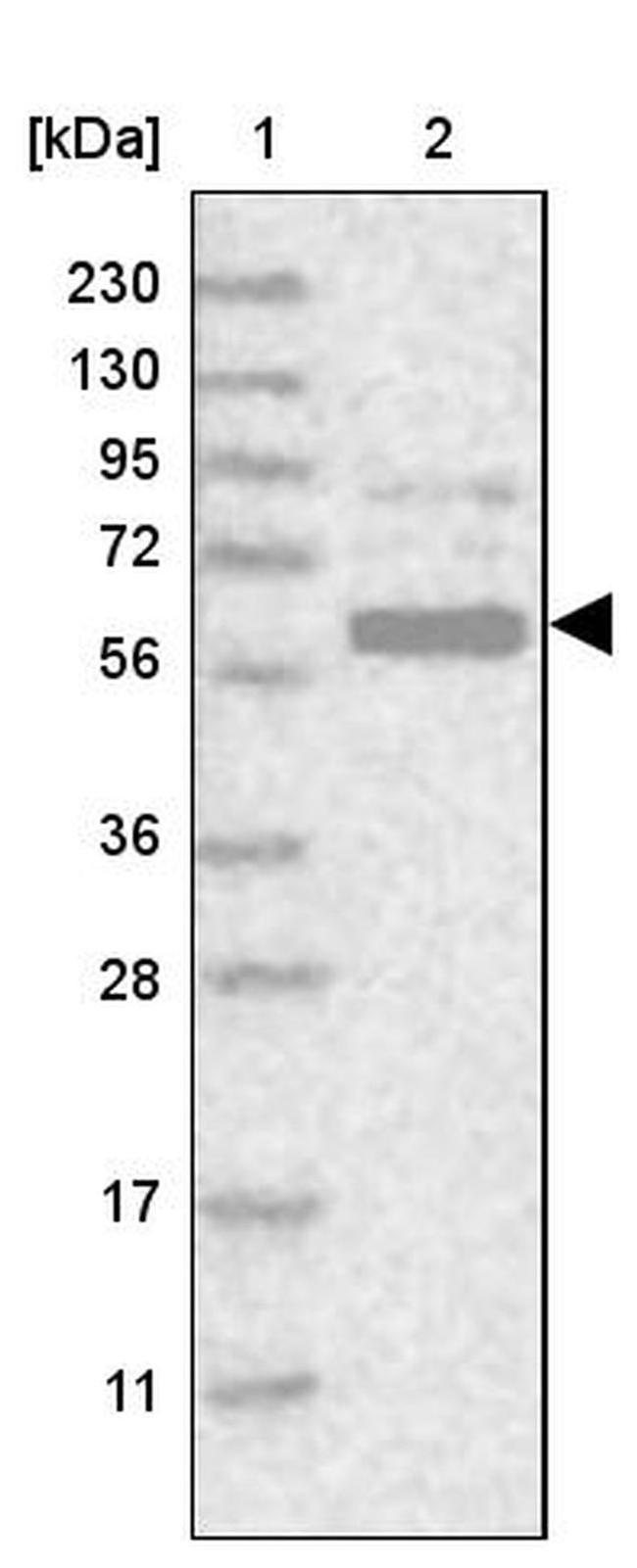 GPATCH2 Antibody in Western Blot (WB)