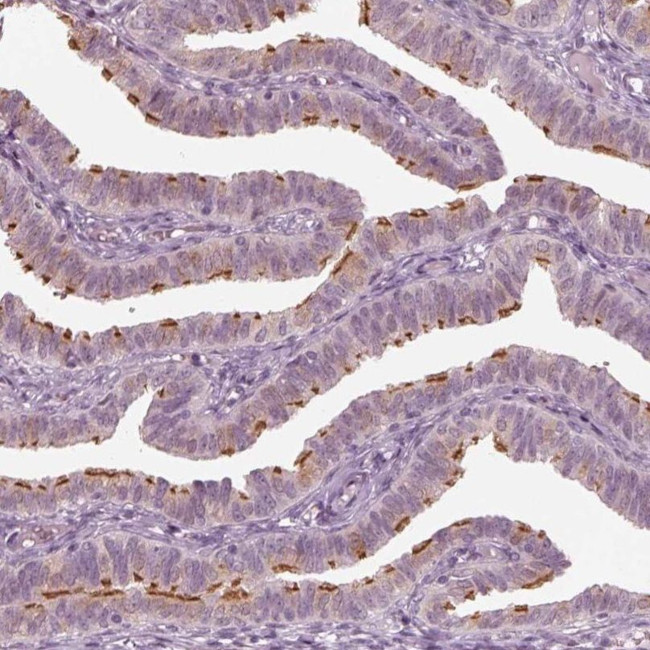 C6orf97 Antibody in Immunohistochemistry (IHC)