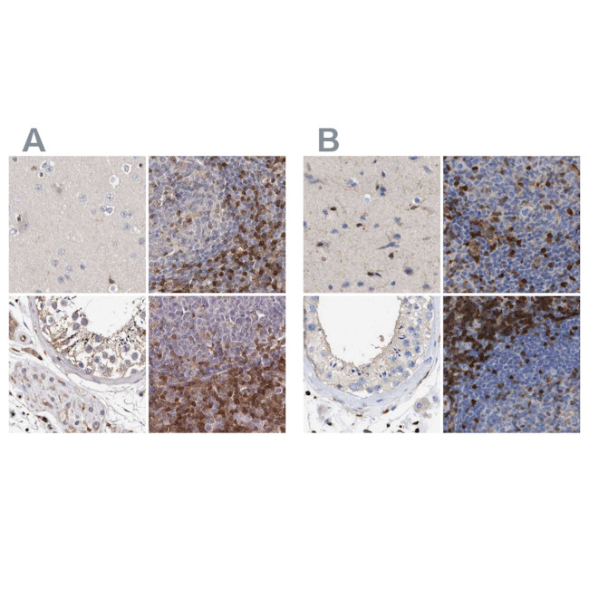 GIMAP4 Antibody in Immunohistochemistry (IHC)