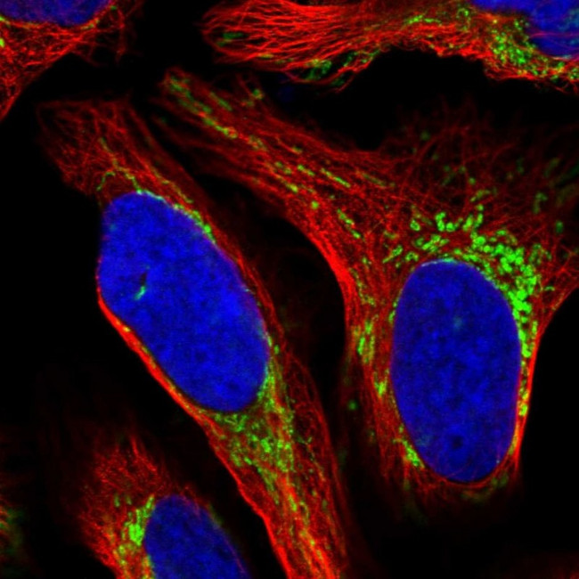 RT28 Antibody in Immunocytochemistry (ICC/IF)