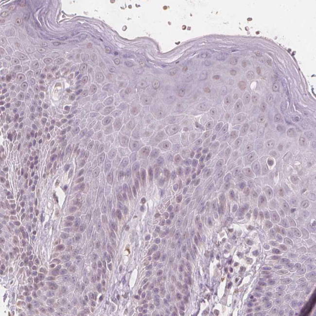 ERICH5 Antibody in Immunohistochemistry (Paraffin) (IHC (P))