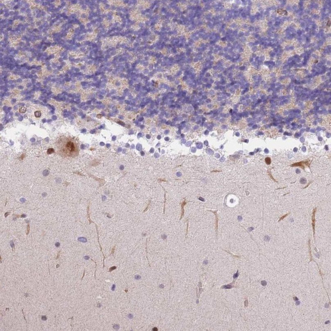 S100PBP Antibody in Immunohistochemistry (IHC)