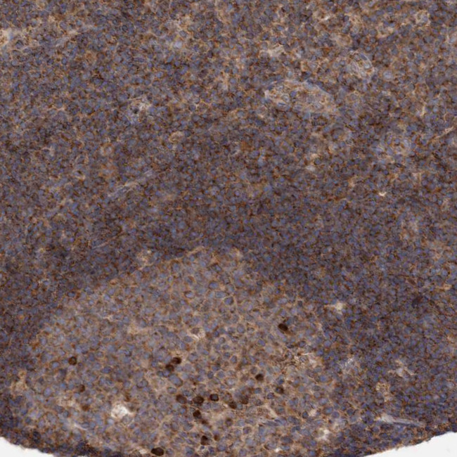 KIF21B Antibody in Immunohistochemistry (Paraffin) (IHC (P))