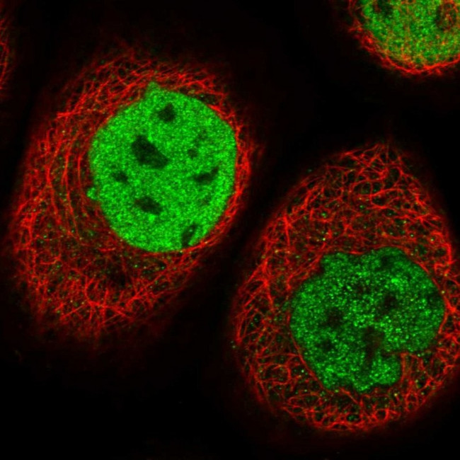 TESK2 Antibody in Immunocytochemistry (ICC/IF)