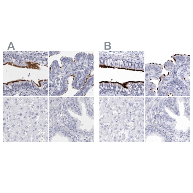 CCDC181 Antibody in Immunohistochemistry (IHC)