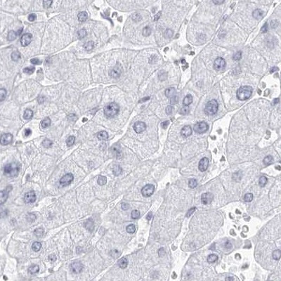 CCDC181 Antibody in Immunohistochemistry (IHC)