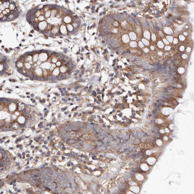 ADCK4 Antibody in Immunohistochemistry (Paraffin) (IHC (P))