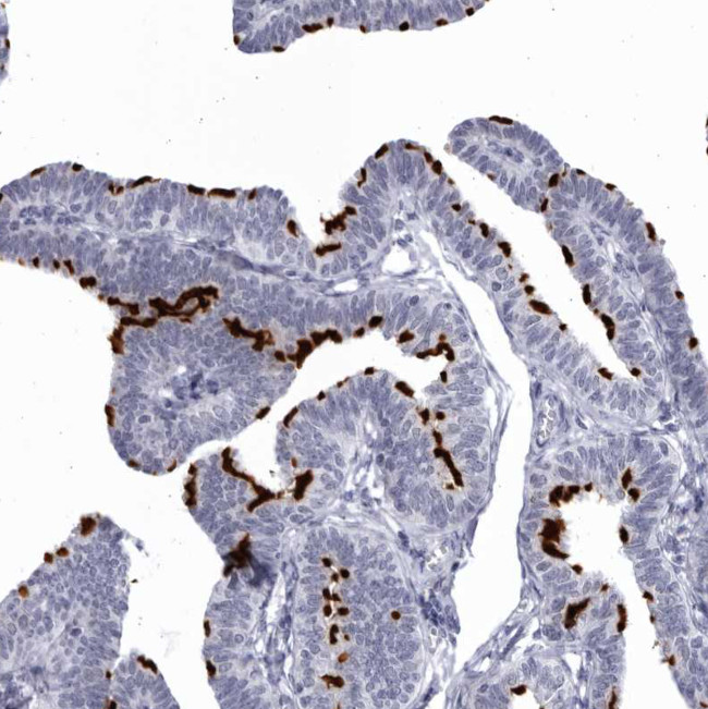 CCDC181 Antibody in Immunohistochemistry (Paraffin) (IHC (P))