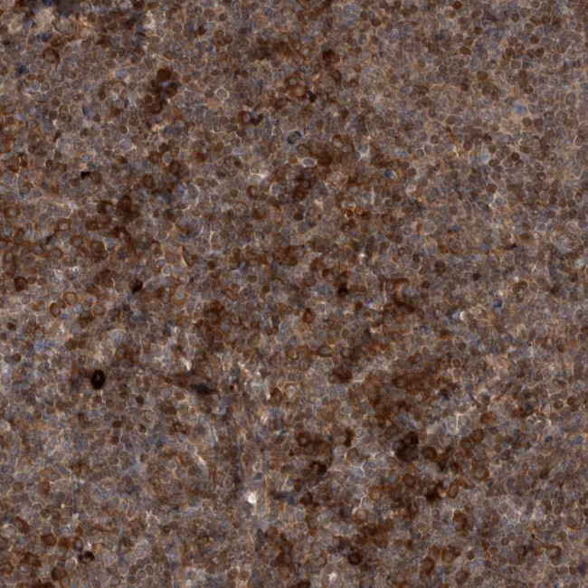 RAB3GAP2 Antibody in Immunohistochemistry (Paraffin) (IHC (P))