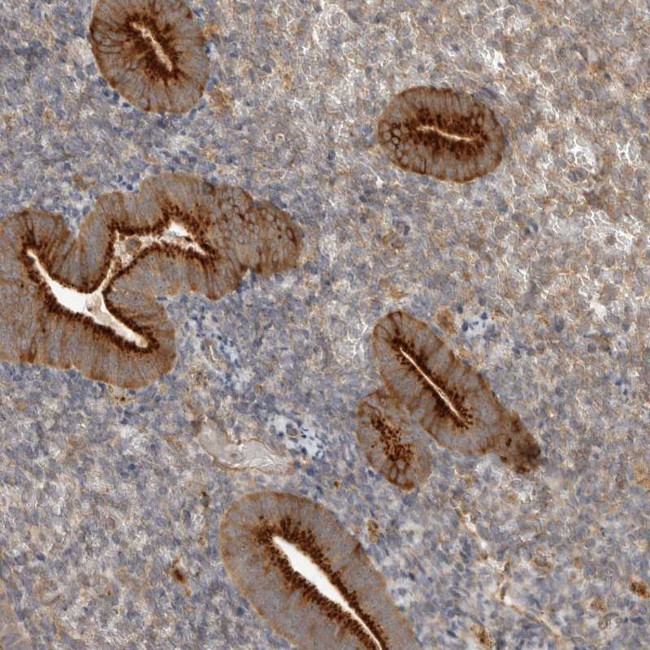 ZNF232 Antibody in Immunohistochemistry (Paraffin) (IHC (P))