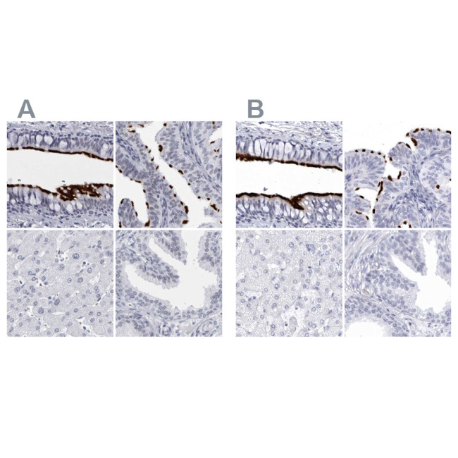 CCDC181 Antibody in Immunohistochemistry (IHC)