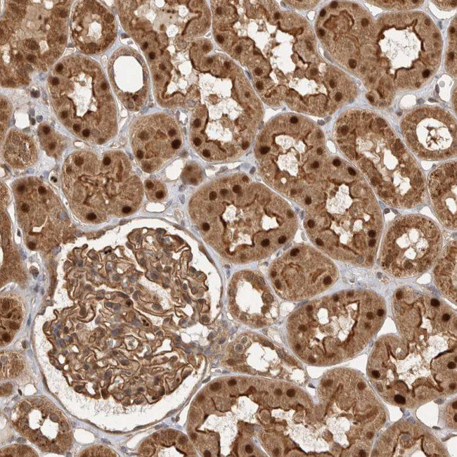STRAP Antibody in Immunohistochemistry (Paraffin) (IHC (P))