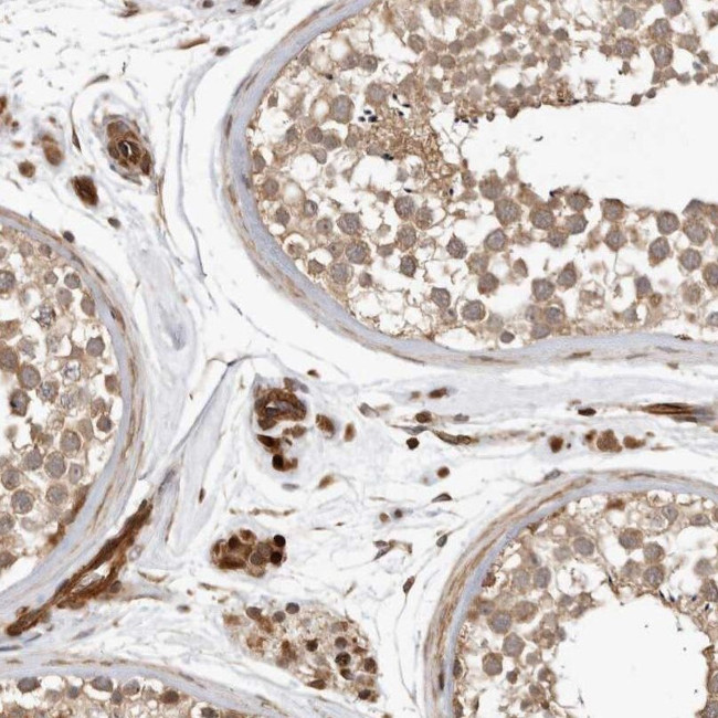 GPATCH2 Antibody in Immunohistochemistry (IHC)