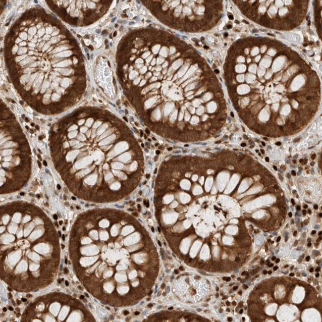 SNRNP40 Antibody in Immunohistochemistry (Paraffin) (IHC (P))