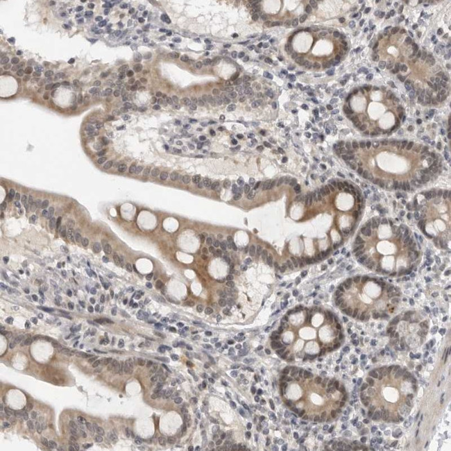 ALPK2 Antibody in Immunohistochemistry (Paraffin) (IHC (P))