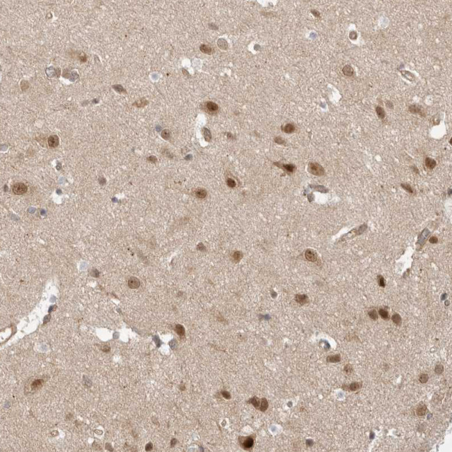 DCAF8 Antibody in Immunohistochemistry (Paraffin) (IHC (P))