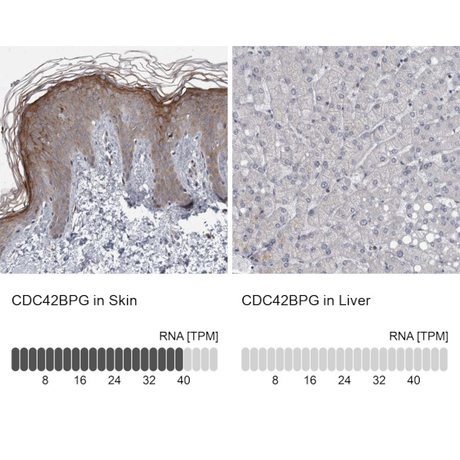 MRCK gamma Antibody in Immunohistochemistry (IHC)