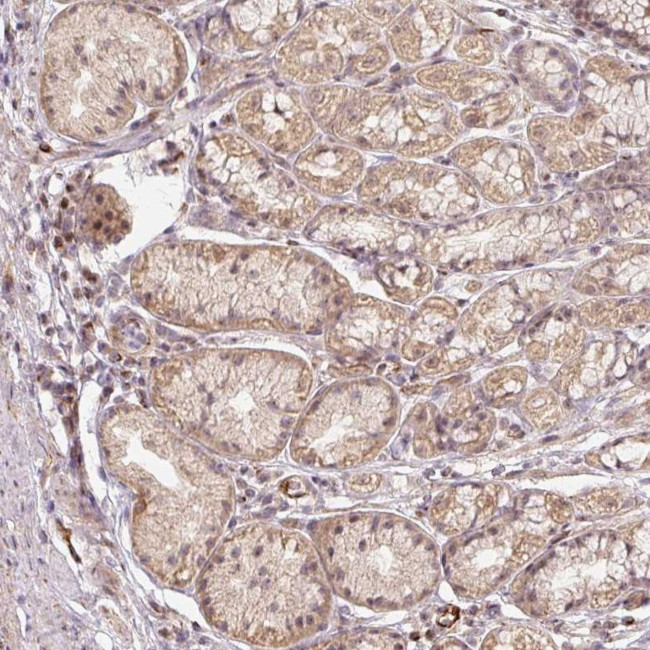 MMACHC Antibody in Immunohistochemistry (IHC)
