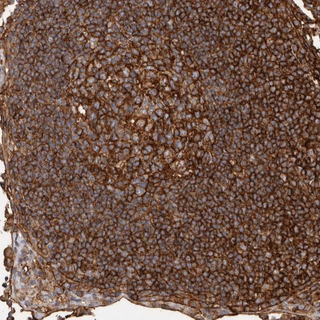 MMACHC Antibody in Immunohistochemistry (Paraffin) (IHC (P))