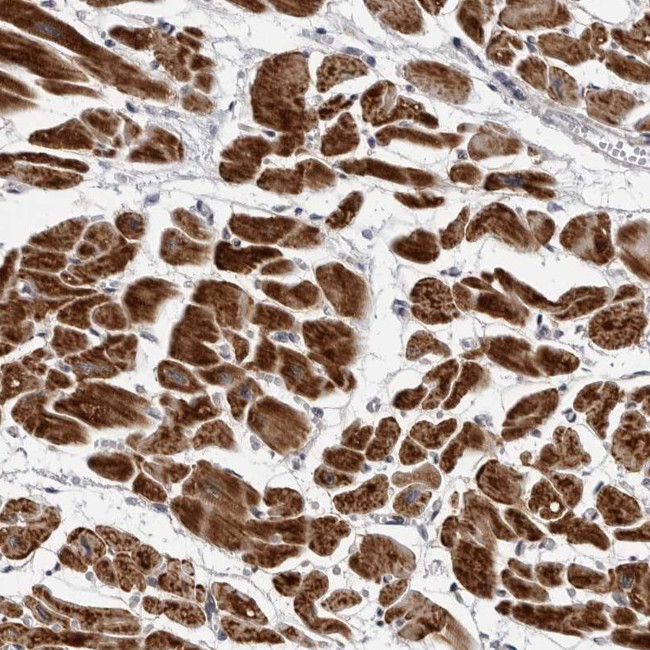 CDK20 Antibody in Immunohistochemistry (Paraffin) (IHC (P))