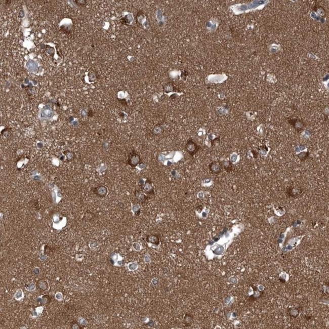 GAK Antibody in Immunohistochemistry (Paraffin) (IHC (P))