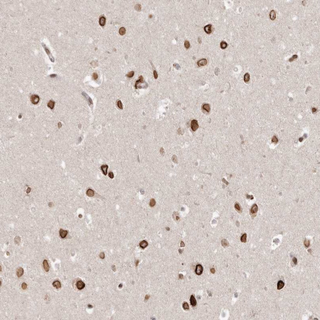 GSG2 Antibody in Immunohistochemistry (Paraffin) (IHC (P))