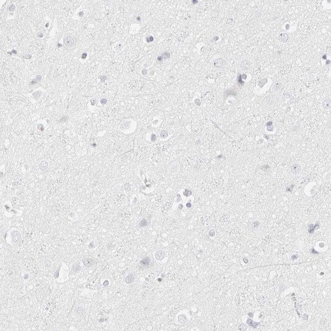 HMGCS2 Antibody in Immunohistochemistry (Paraffin) (IHC (P))