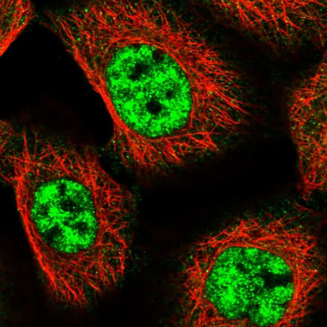 MED18 Antibody in Immunocytochemistry (ICC/IF)