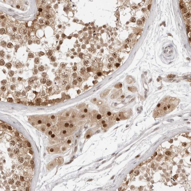C8orf48 Antibody in Immunohistochemistry (Paraffin) (IHC (P))